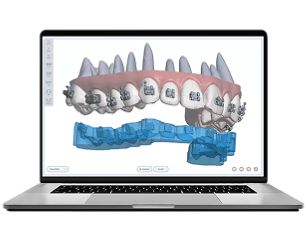 digital orthodontics